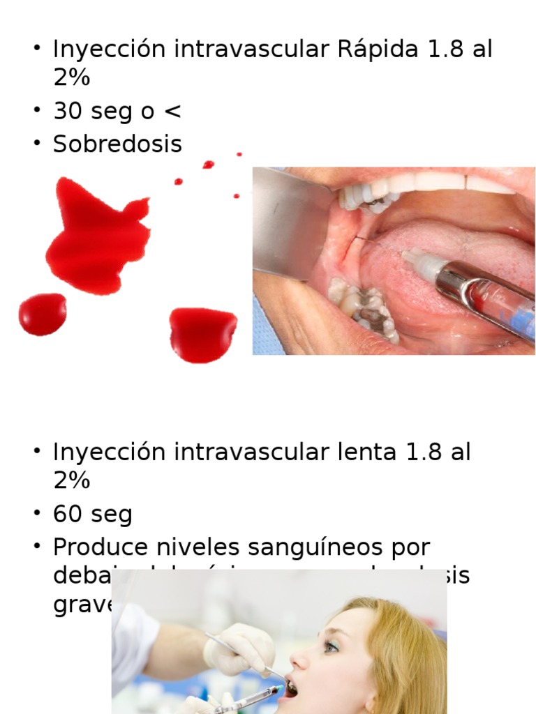Inyección Intravascular: Dosis y Tiempos | PDF