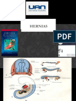 hernias 3