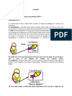 PR BPPV Kadhaf Harie Cipta Bagaimana Mekannisme Trauma Menyebabkan BPPV ?