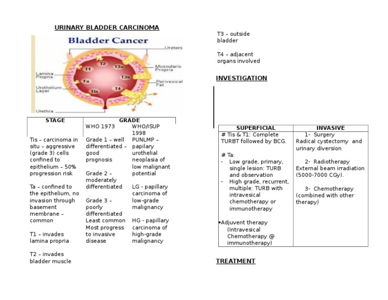 Bladder Cancer Staging & Treatment | PDF