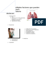 Causas Paro Cardiorespiratotio