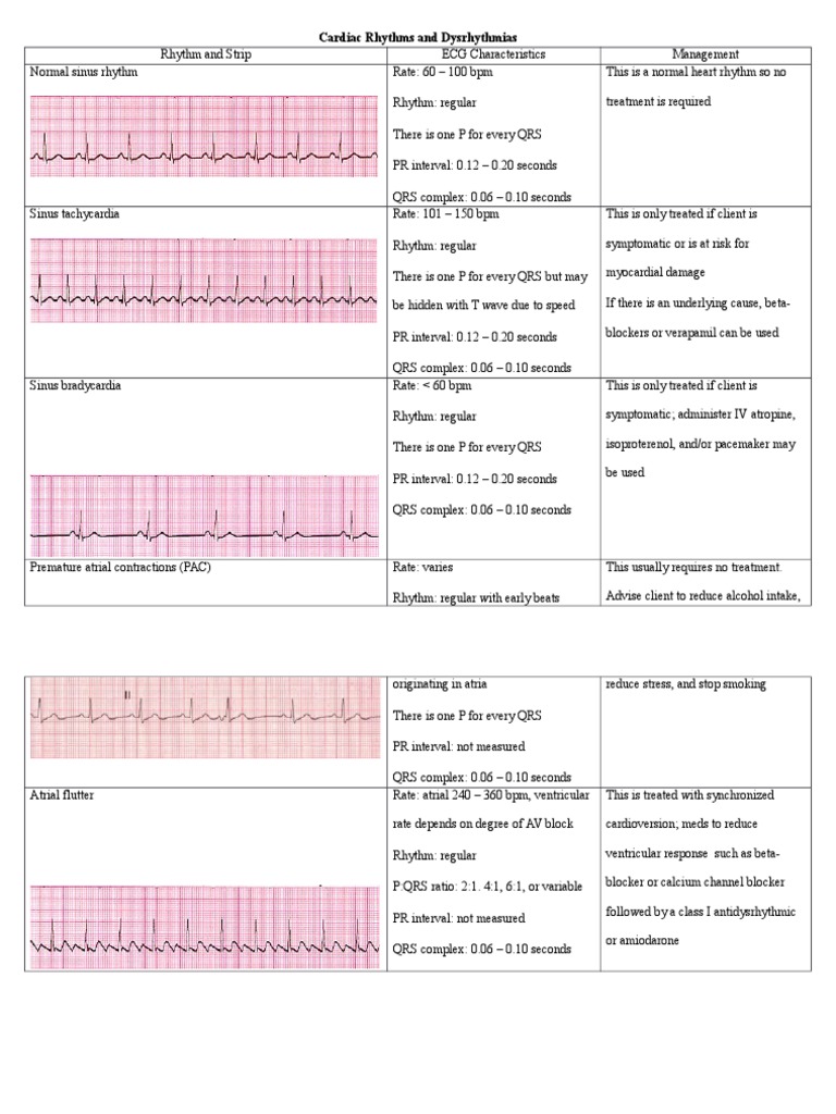 ECG Characteristics and Management of Cardiac Rhythms | PDF | Cardiac ...