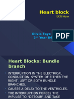 Heart Block Report