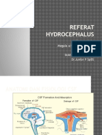 Hydrocephalus