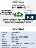 Stemi Inferior