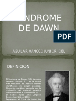 Sindrome de Dawn