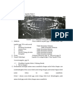 Klasifikasi Impaksi Molar 3