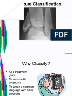 AO Classification of Fracture