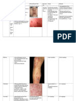 Tabel Osce Pioderma Dan Virus