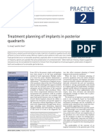 Treatment Planning of Implants in Posterior Quadrants