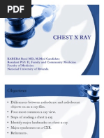 Download Chest X Ray- KABERA Rene  by KABERA RENE  SN31431993 doc pdf