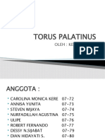 Torus Palatinus Slide