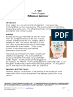 Sinus Surgery