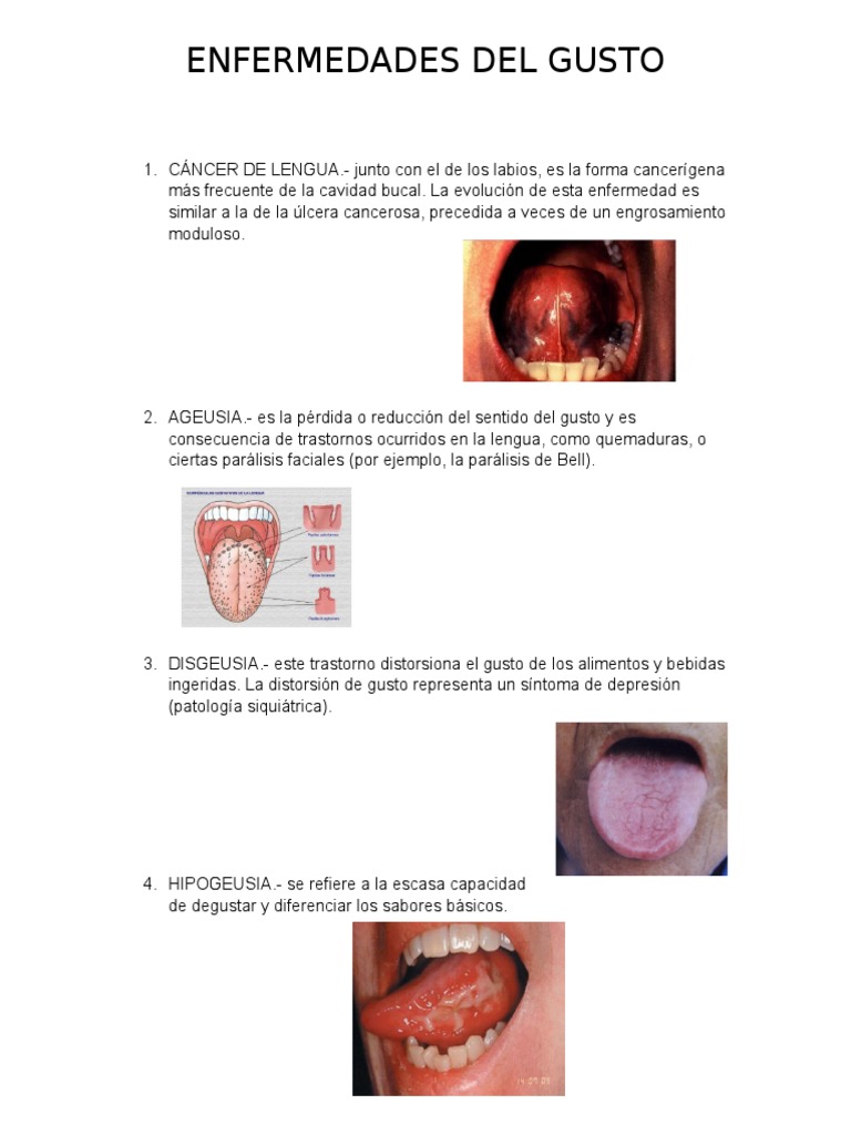 Enfermedades Del Gusto