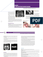 Otitis Medias Cronicas Colesteatomatos