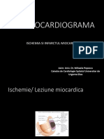 Curs 3 EKG IMA, Hipertrofii Modif