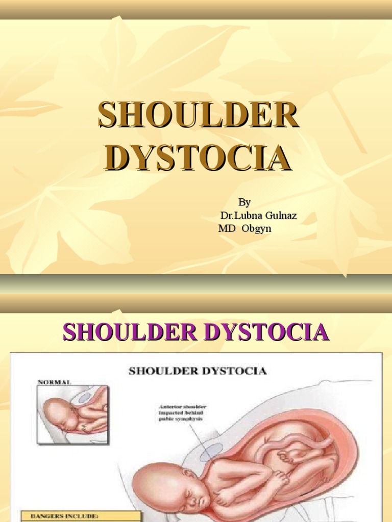 Shoulder Dystocia Woods Screw Maneuver