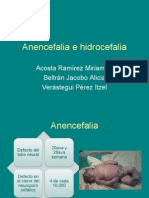 Anencefalia e Hidrocefalia