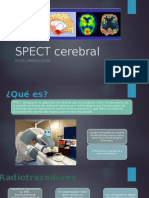 SPECT Cerebral