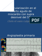 Revascularizacion en El Infarto Agudo de Miocardio