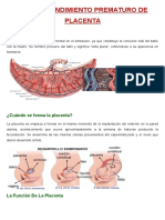 Desprendimiento prematuro placenta