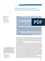 Influence of Cigarette Smoking On White Matter in Patients With Clinically Isolated Syndrome As Detected by Diffusion Tensor Imaging