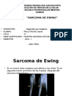 Sarcoma de Ewing