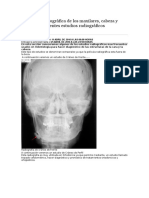 Anatomía Radiográfica de Los Maxilares