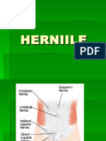 hernii