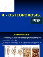 04 Osteoporosis