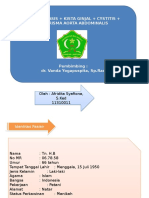 nefrolitiasis