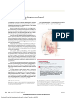 Appendicitis