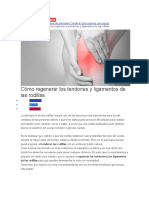 Ligamentos Rodillas