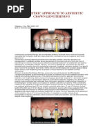 A Biometric Approach To Aesthetic Crown Lengthening