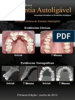 Ortodontia Autoligavel - Revista