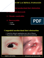 08Infection Lacrimal