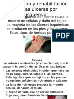 Prevención de Ulceras Por Isquemia