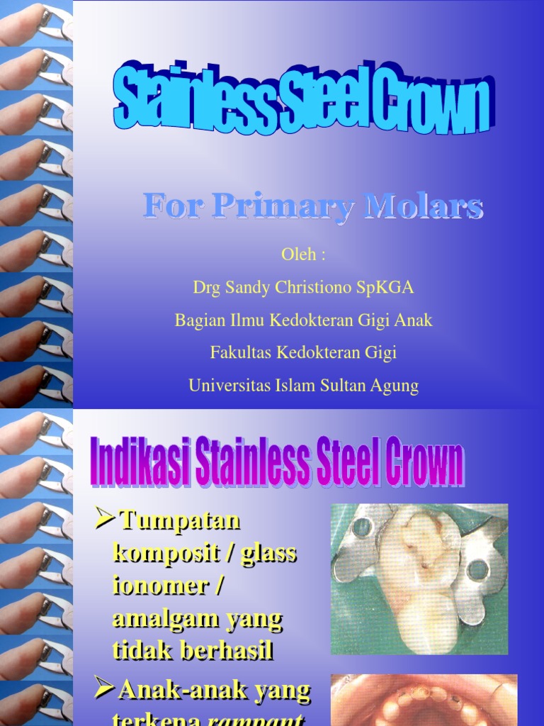 Stainless Steel Crown