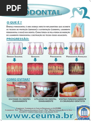 Banner Doenca Periodontal