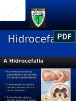 Hidrocefalia