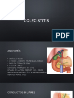 Colecistitis