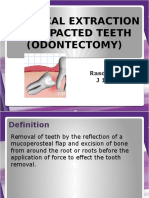 Surgical Extraction of Impacted Teeth (Odontectomy) : Rasdiana Bakri J 111 07 065