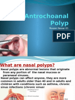 Antrochoanal Polyp