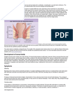 Development of Hemorrhoids: Anal Canal Anatomy