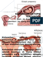 Kehamilan Ektopik Terganggu