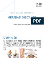 Hernia Discal