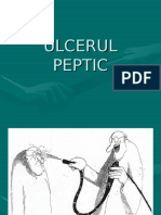 Ulcerul Peptic