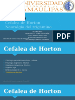 CEFALEA - Cefalea de Horton. Tic Doloroso (Neuralgia) Del Trigemino
