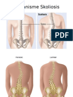 Mekanisme Skoliosis Tutor 4 Blok 2