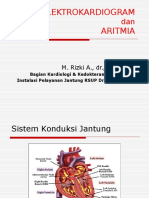 EKG Dan Aritmia